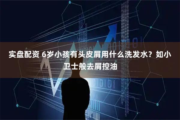 实盘配资 6岁小孩有头皮屑用什么洗发水？如小卫士般去屑控油